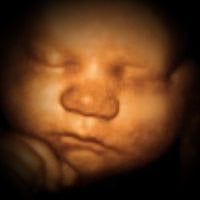 Foto scattata a Vegas Baby 4d Ultrasound da Vegas Baby 4d Ultrasound il 4/26/2022