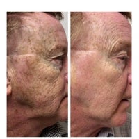 Skin Md Laser Cosmetic Group Health Beauty Service In South Peabody