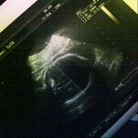 Review Dokter kebidanan & kandungan Dr.Phyo,SpOG