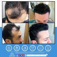 Vatanmed Sac Ekim Merkezi Beauty Hair Transplant Center Molla Gurani Istanbul Marmara