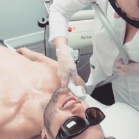 Laser Hair Removal In Nyc Infinity Laser Spa Nomad 866