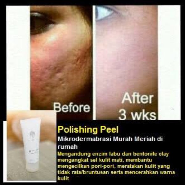 Soft peel полирующий пилинг–гоммаж. Polishing peel. Polishing peel. Polishing peel. Polishing peel.