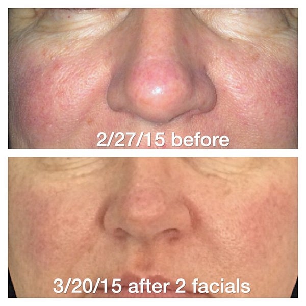 Foto tirada no(a) Tamara&#39;s Skin Care Clinic por Tamara B. em 3/20/2015