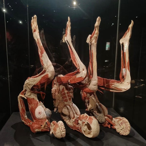 Photo taken at Body Worlds by SA on 7/24/2022