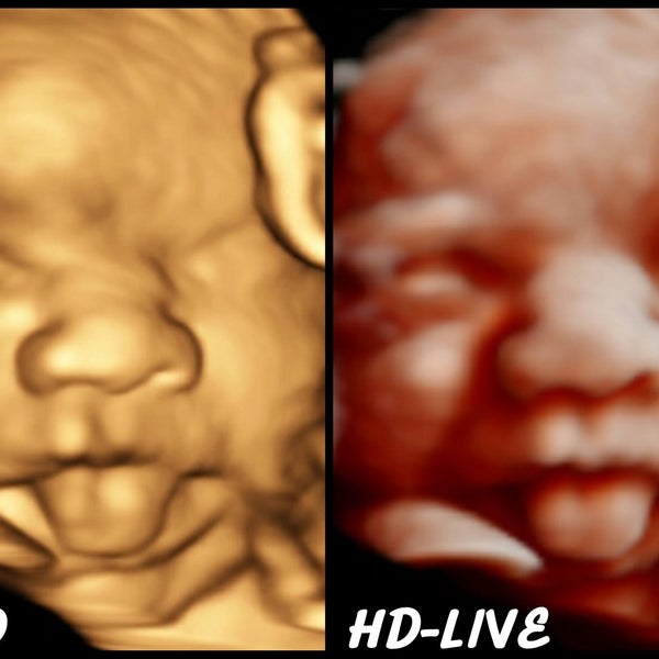 3d/4d sonogram near me