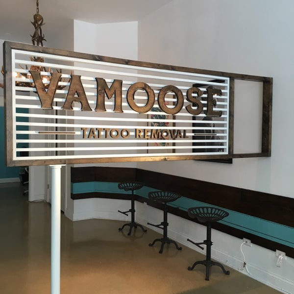 Vamoose Tattoo Removal, Şikago, IL, vamoose tattoo removal, Dövme.