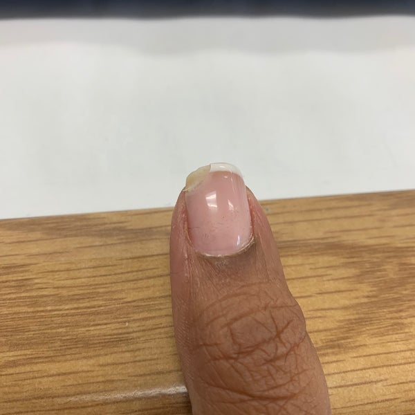 Faint line on nail of ring finger. Is this melanoma? (25M, South Asian) :  r/Melanoma