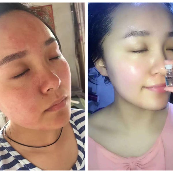 同一张脸,皮肤的好坏真的太重要了?