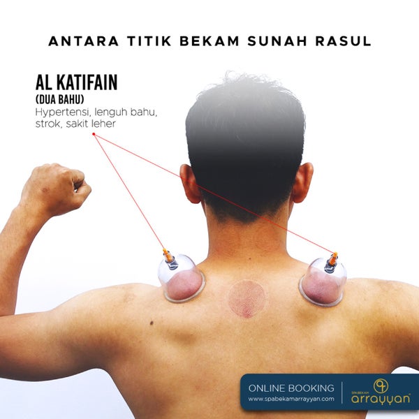 Photos At Spa Bekam Ar Rayyan Kuantan Physical Therapist In Tanjung Lumpur
