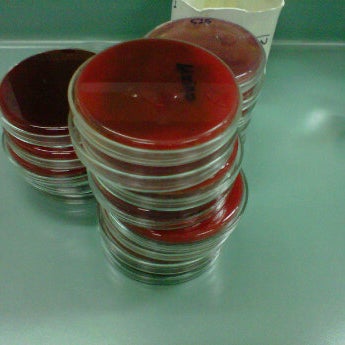 Laboratorium Mikrobiologi Departemen Patologi Klinik FKUI/RSCM Jakarta ...