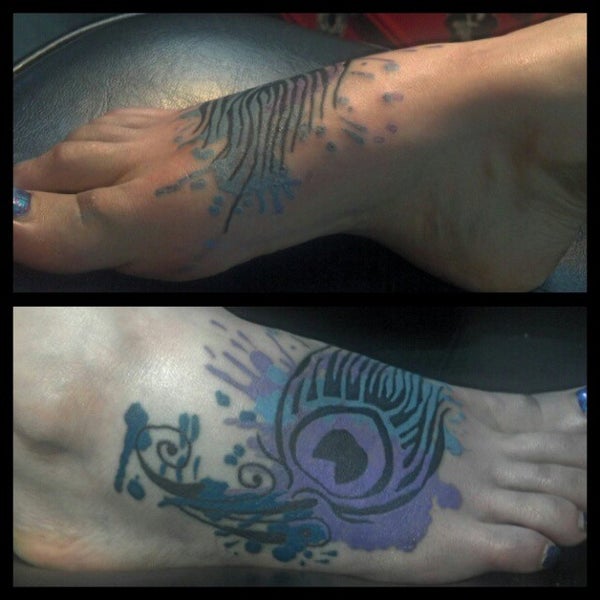 Discover more than 59 tattoo removal fort collins best in.eteachers