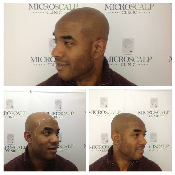 Photos At Micro Scalp Clinic Health Beauty Service In Boston