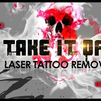 Laser Tattoo Removal  Colorado  No Regrets Laser Services