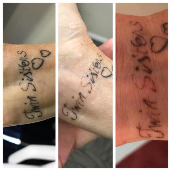 Photos at Shipers Laser Tattoo Removal Center Dallas - Health & Beauty Service Photos at Shipers Laser Tattoo Removal Center Dallas - Health & Beauty Service
