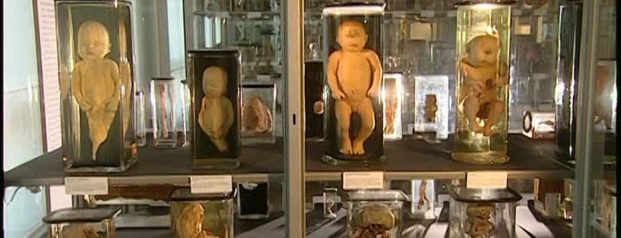Medizinhistorisches Museum is one of Posti che sono piaciuti a genilson.