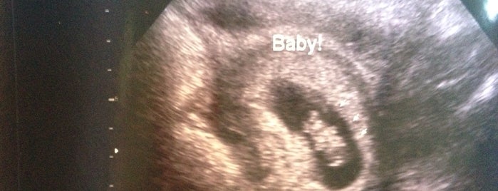 Baby Bound Ultrasound is one of สถานที่ที่ Slightly Stoopid ถูกใจ.