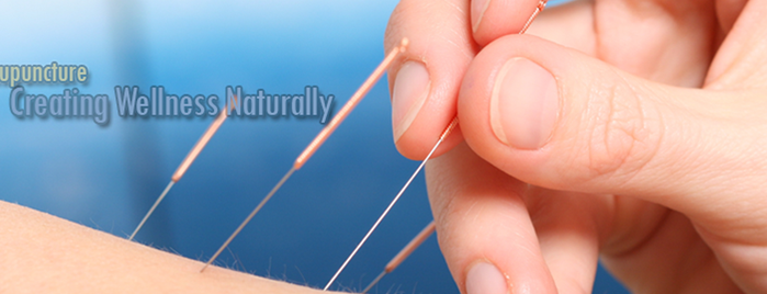 Crofton Acupuncture is one of Posti che sono piaciuti a Alinka.