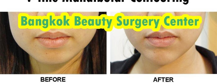Bangkok Beauty Surgery Center