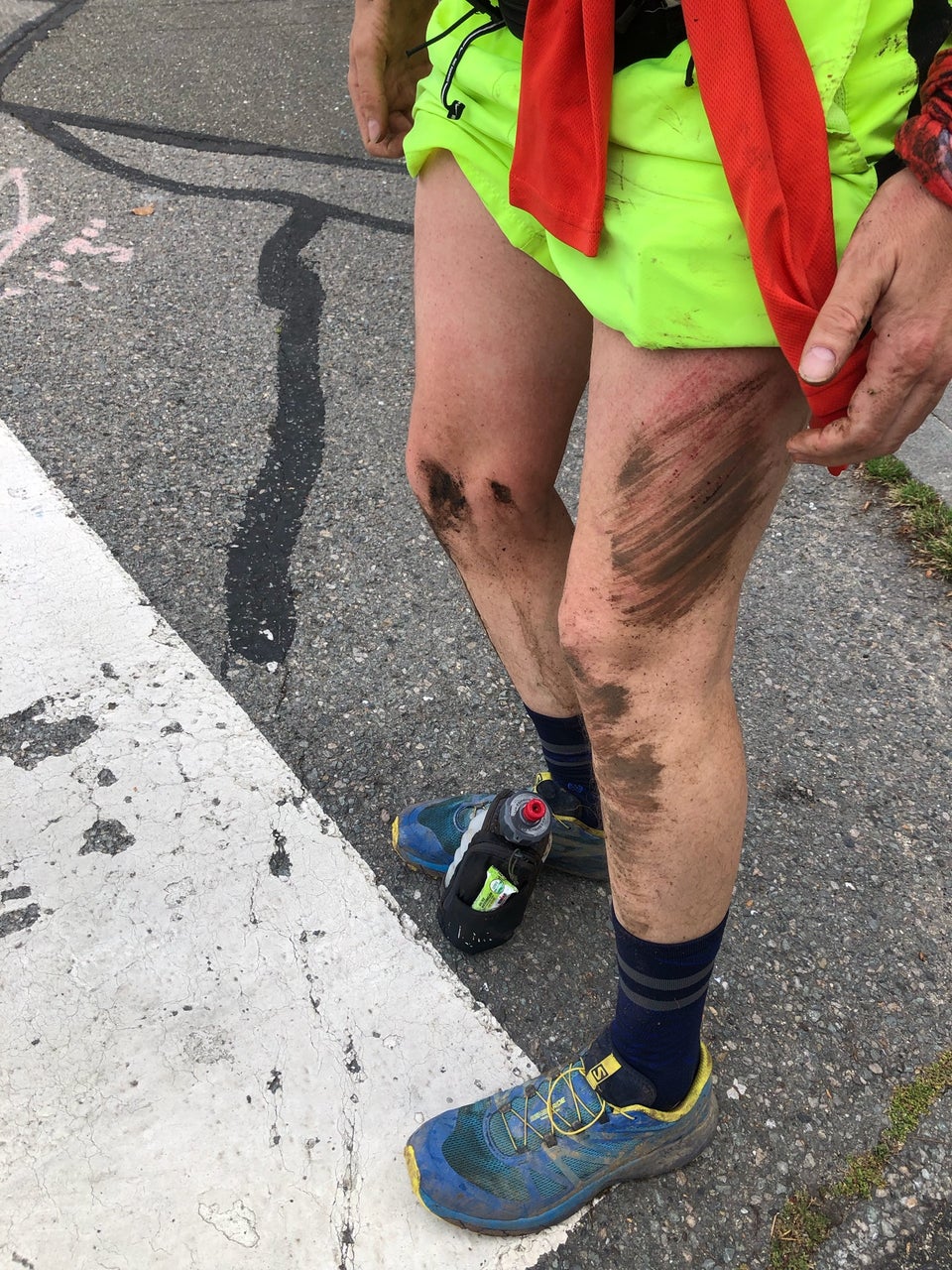 Tantek standing, mud and scrapes on left leg and right shin, standing on asphalt